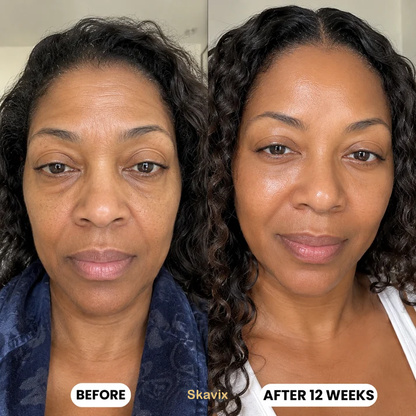 Skavix® Plumping Gel Face Mask